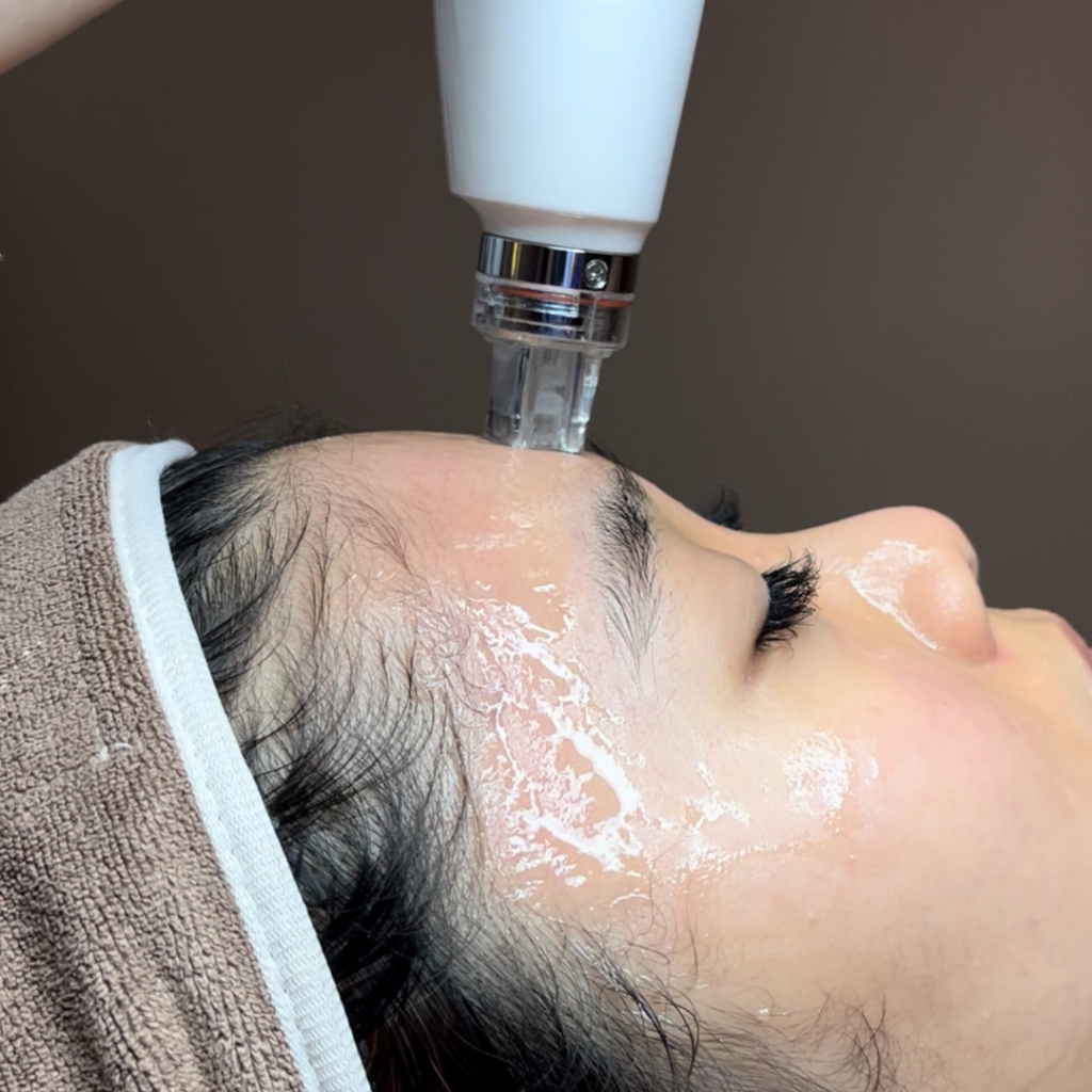 Facial Treatments in Malaysia: Your Complete Guide to Healthy, Glowing Skin​